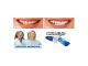 Blanqueador dental white light dientes blancos - Foto 3