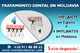 Tratamientos dentales eficaces en las clínicas de moldavia