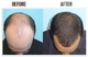 Alopecia? claridades? Prueba gratuita!! - Foto 1