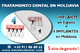 Turismo dental - un gran ahorro para los extranjeros - Foto 1