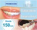 Blanqueamiento dental desde 150 eur